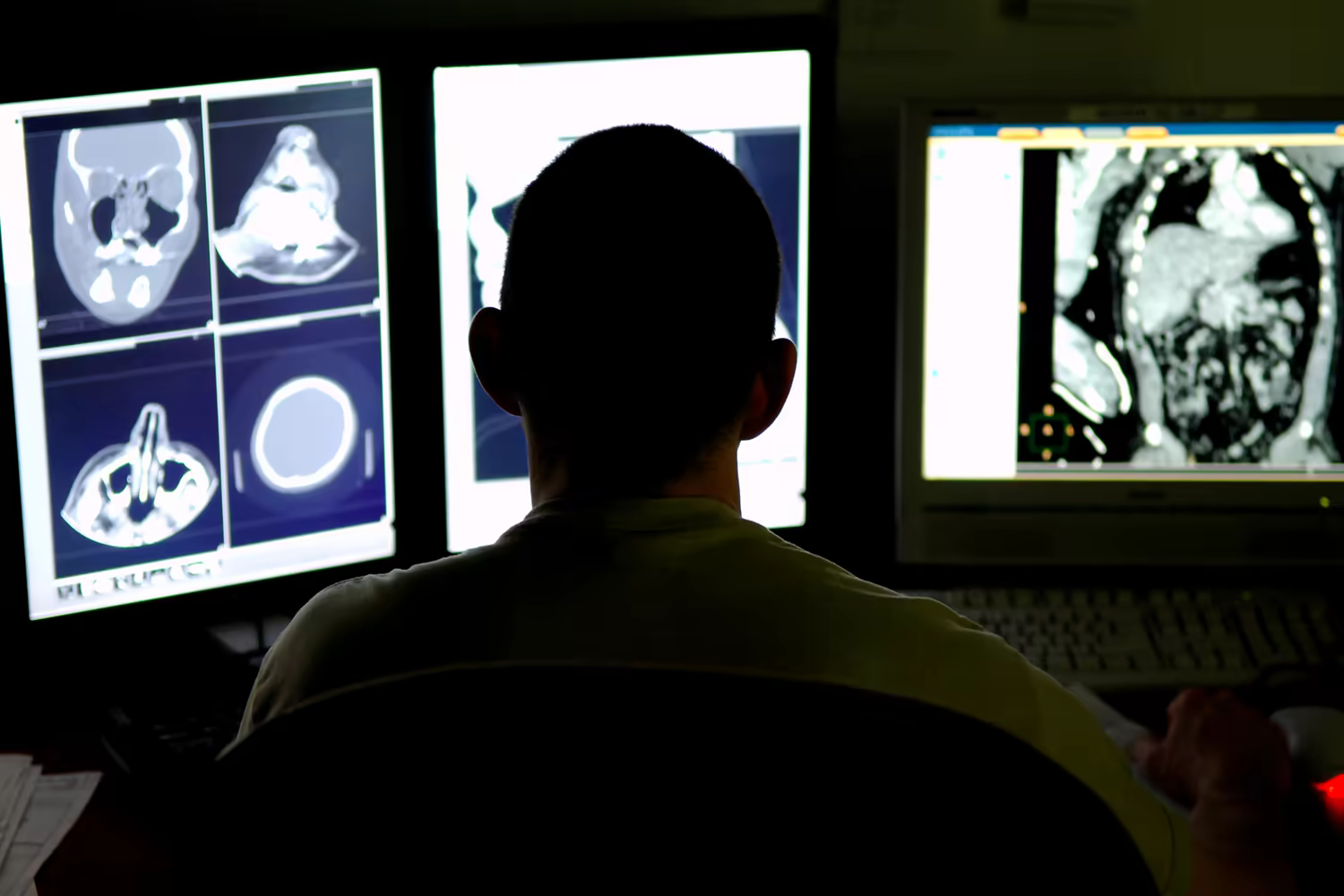 Radiologista observa exames de tomografia em três monitores Radiologista observa exames de tomografia em três monitores