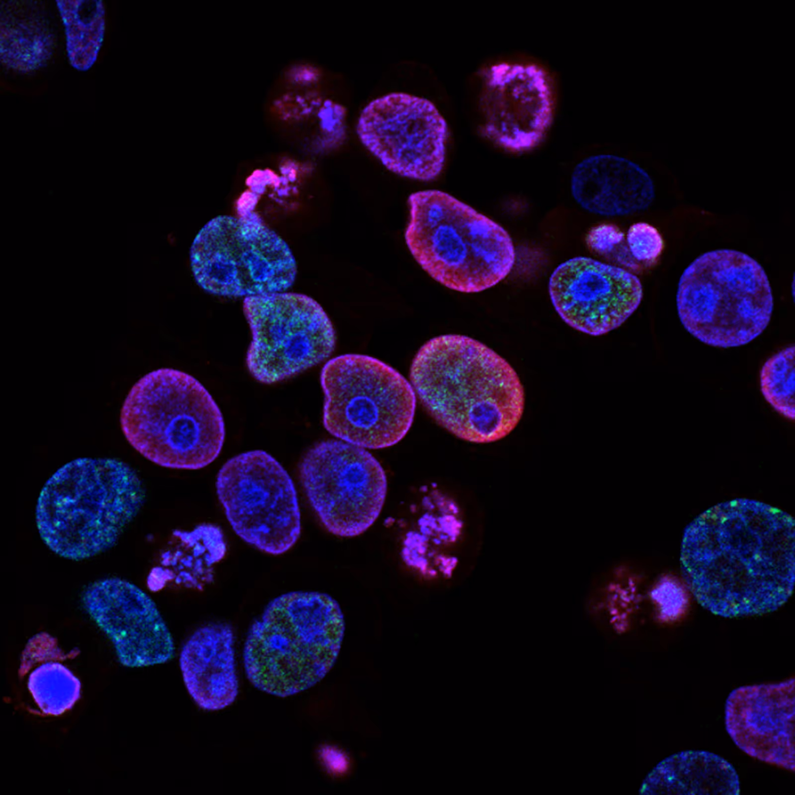 Células cancerosas humanas colorretais vistas ao microscópio com coloração fluorescente em azul, vermelho e verde, imagem de pesquisa do National Cancer Institute Células cancerosas humanas colorretais vistas ao microscópio com coloração fluorescente em azul, vermelho e verde, imagem de pesquisa do National Cancer Institute