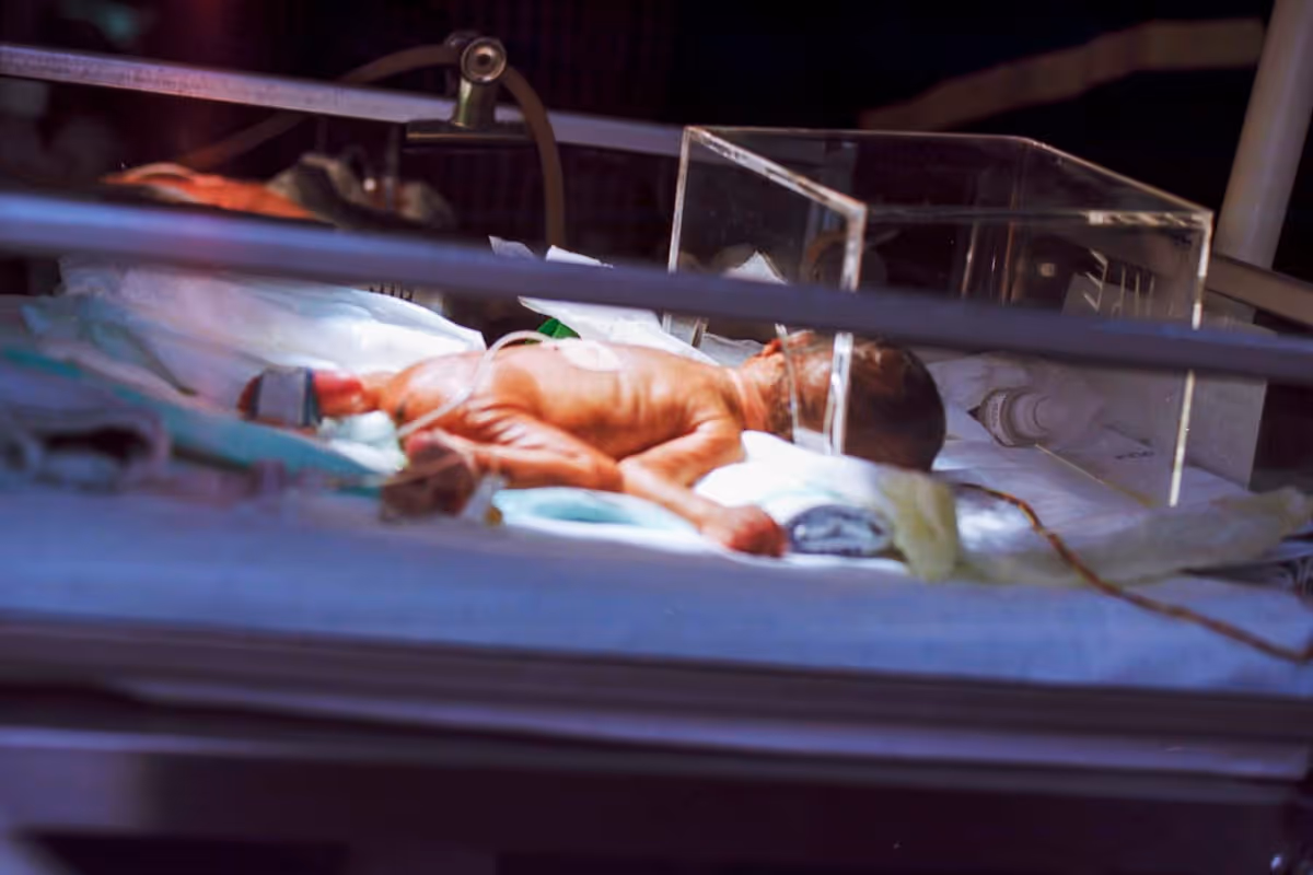 Bebê prematuro em incubadora de UTI neonatal com monitores